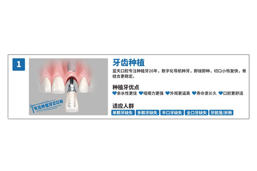 蓝天口腔种植牙优势图