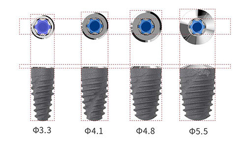 卡尔斯种植牙植体型号
