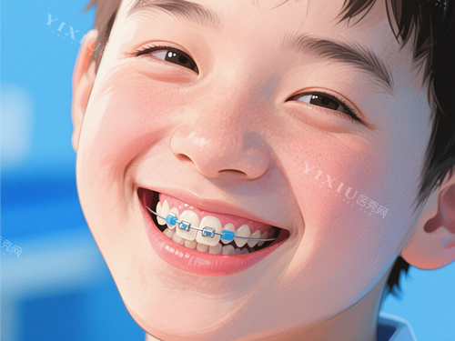 儿童金属托槽矫正
