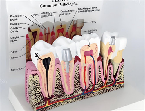 牙齿模型解剖图片