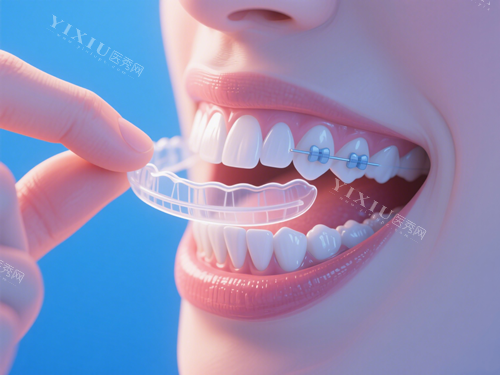 隐形牙套和附件