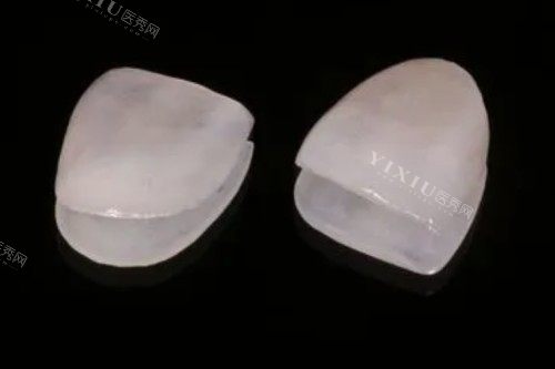 牙贴面材料卡通图