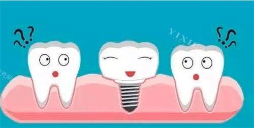 蚌埠沪芽口腔种植牙怎么样？价格优惠、医生技术娴熟、患者反馈好、服务贴心周到！(图3)