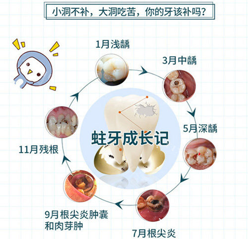 蛀牙发展过程