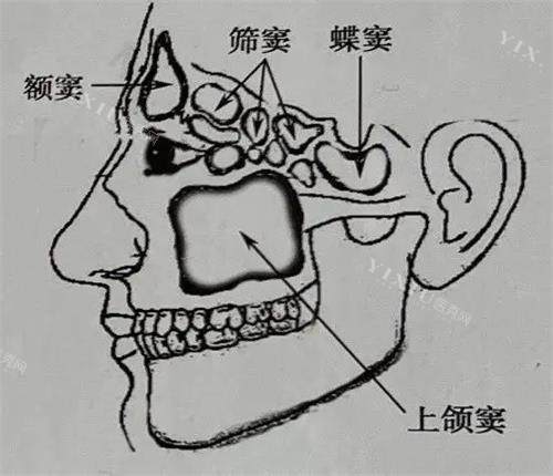 上颌窦位置示意图