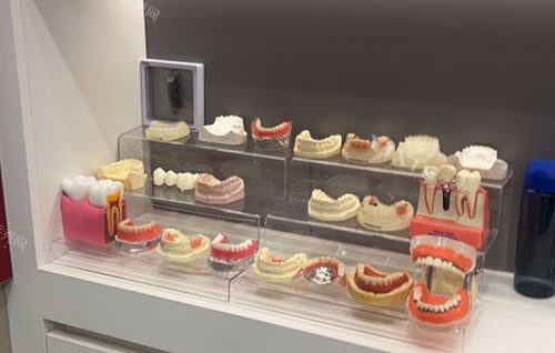 上虞小宽口腔牙齿模型展示图
