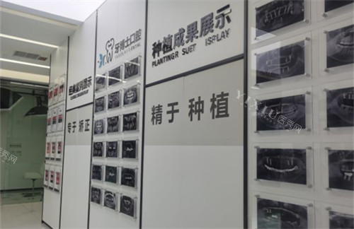 贵阳牙博士口腔实例展示区环境图