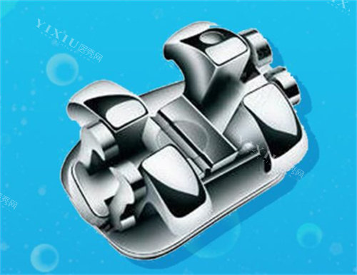 钢丝牙套一般要戴多久？通常需要1-3年左右，但佩戴时长因人而异！(图2)