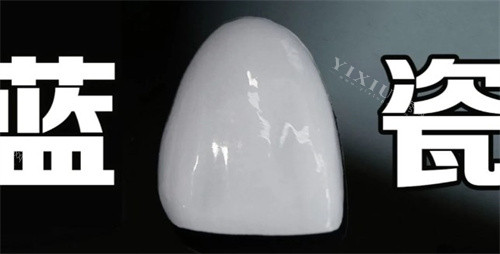 显微瓷贴面优缺点分析！美观自然，但操作难度高、价格较高！(图2)