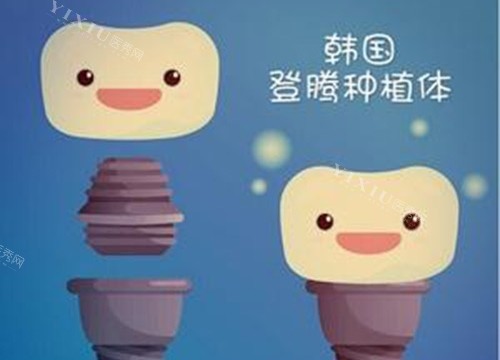 登腾种植体