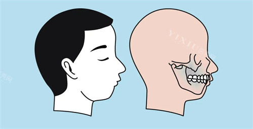 凸嘴的图片