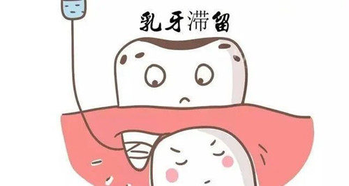 乳牙滞留坏处
