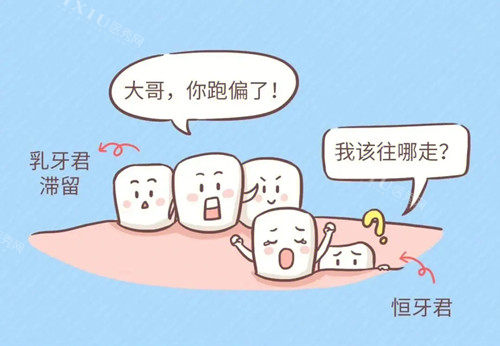 乳牙滞留漫画.webp