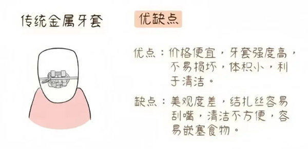 金属牙套手绘照片