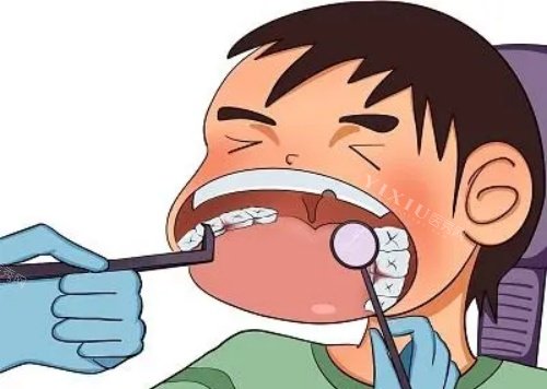 儿童口腔治疗