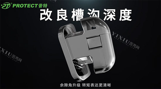 普特牙套技术特色