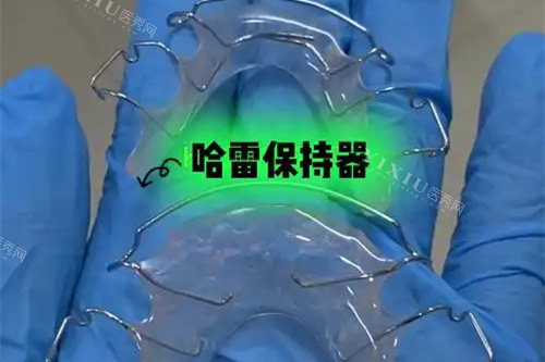 哈雷保持器