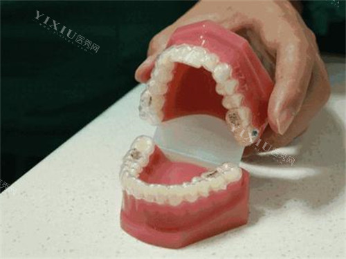 应城牙齿治疗收费标准分享，2025年做种植牙2980+牙齿矫正6000+补牙98+点击了解！(图3)