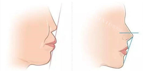 延吉牙博士口腔怎么样？本地人亲测：技术靠谱、服务贴心，看牙就选它！(图4)