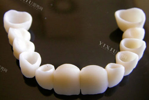 担心牙冠做了里面真牙会烂？看完这篇揭秘文让你不再忧心！(图1)