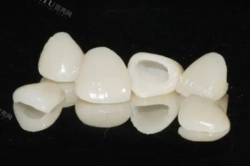 担心牙冠做了里面真牙会烂？看完这篇揭秘文让你不再忧心！(图2)