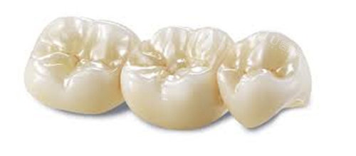 担心牙冠做了里面真牙会烂？看完这篇揭秘文让你不再忧心！(图4)