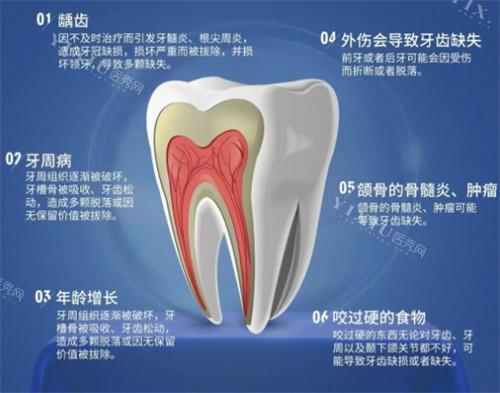 牙齿缺失原因