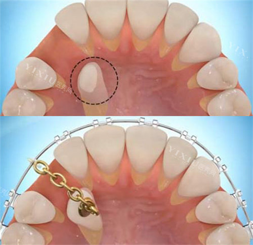 河北保定唐县广场口腔2026价格表上新：洗牙95元起／补牙260元起／牙齿美白450元起！(图2)