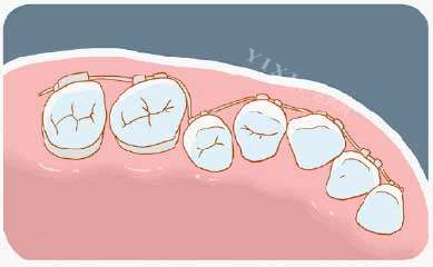 河北保定顺平科雅口腔价格表更新：牙齿矫正5999元起、种植牙5299元起、烤瓷牙3599元起(图2)