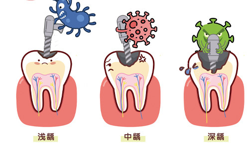 西安莎莎口腔周末急诊服务！拔智齿220元起，夜间营业至晚8点！(图3)