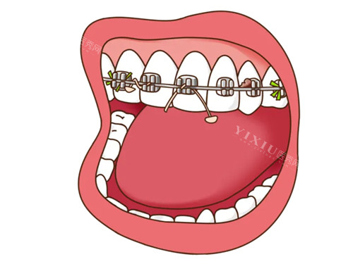 牙齿出现问题卡通图