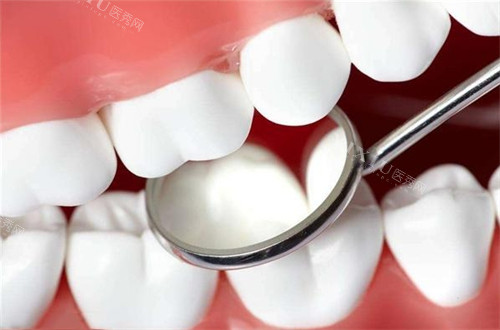 石家庄三博口腔多少钱？种植牙3500元起、牙齿矫正5000元起、补牙150元起、牙冠800元起！(图5)