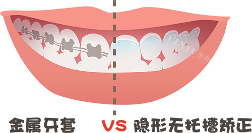 牙齿卡通图片展示