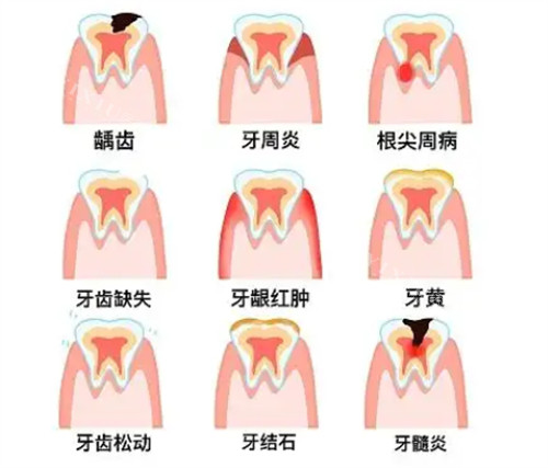 不同牙齿问题