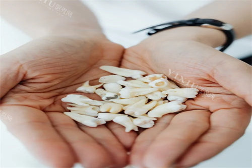 牙齿修复材料