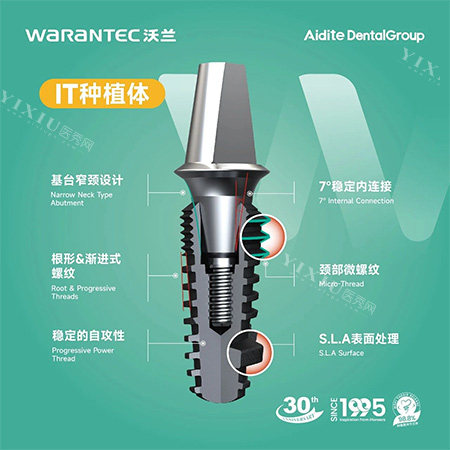 沃兰种植牙IT型号照片