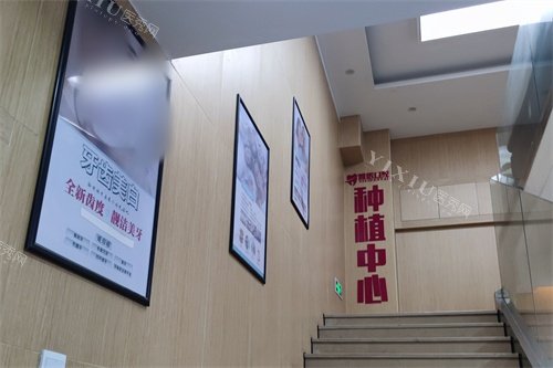 衢州雅医口腔种植中心楼梯间