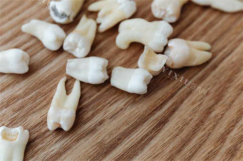 深覆合牙齿矫正前后整体对比图
