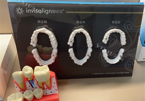 天津伊诚口腔靠谱吗？一家 3 口追随正畸多年，揭秘其口碑密码(图2)