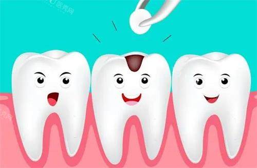 年轻人补牙避坑！松风树脂虽好但有这些弊端，快来了解其他选择！(图3)