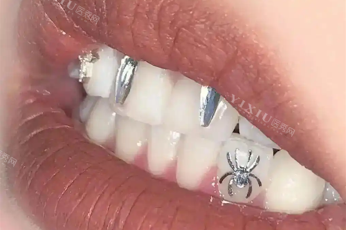 红河吉祥口腔医院电话全解析！预约方式+联系电话+地+到院乘车路线+特色项目分享~(图2)