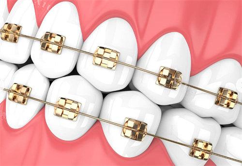 西安格林美口腔地址在哪？雁塔区锦业路88号！预约电话／营业至19：30／实力佳！(图6)