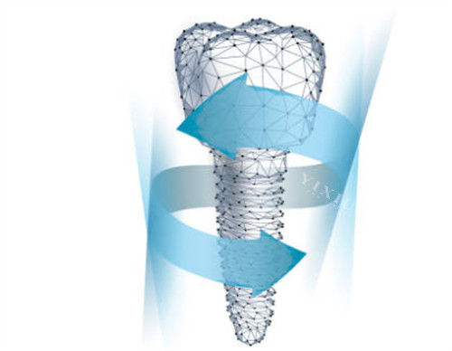 TPP倾斜穿翼板即刻种植和普通植骨种植手术的区别是什么？适应症、治疗周期、术后成效等存在差异！(图5)