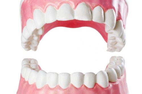 库车锐珂口腔 2025 价格表更新：补牙 200 元起、种植牙 5000 元起、矫正 8000 元起(图5)