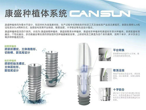 康盛亲水种植体怎么样？国产亲水黑马！表面技术加速骨愈合，价格亲民，骨量一般种牙也能省时间！(图3)