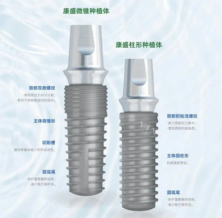 康盛亲水种植体怎么样？国产亲水黑马！表面技术加速骨愈合，价格亲民，骨量一般种牙也能省时间！(图6)