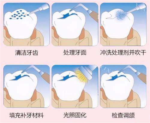 大冶哪里补牙拔牙比较好？从基础补牙到复杂拔牙，中山／渡江／铜都等10家优势及价格全公开！(图5)