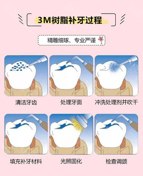 大冶哪里补牙拔牙比较好？从基础补牙到复杂拔牙，中山／渡江／铜都等10家优势及价格全公开！(图6)