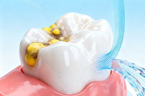 牙齿清洁卡通图