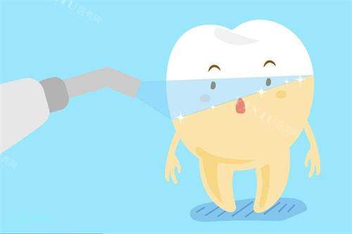 牙齿冷光美白示意图